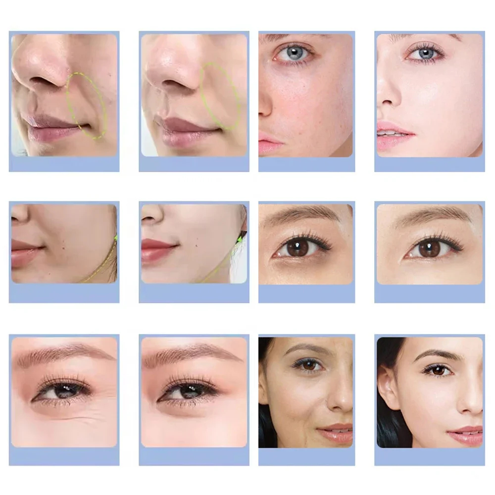 7 Types Facial CO2 Oxygen Bubb - Aha Bha Exfoliant ulasan dan harga