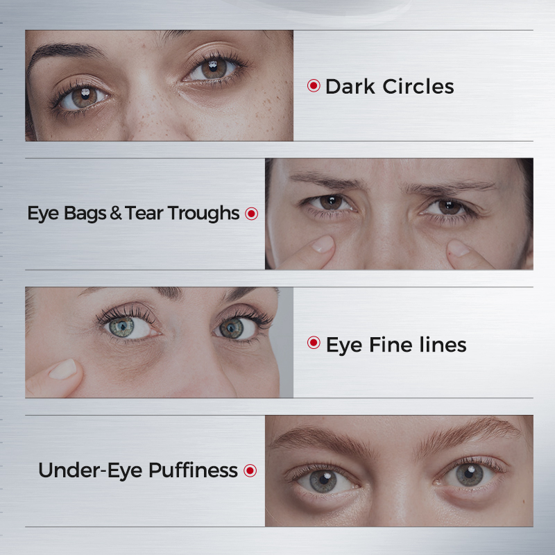 Eye Patches for Dark Circles – - Collagen Sheet Mask ulasan dan harga