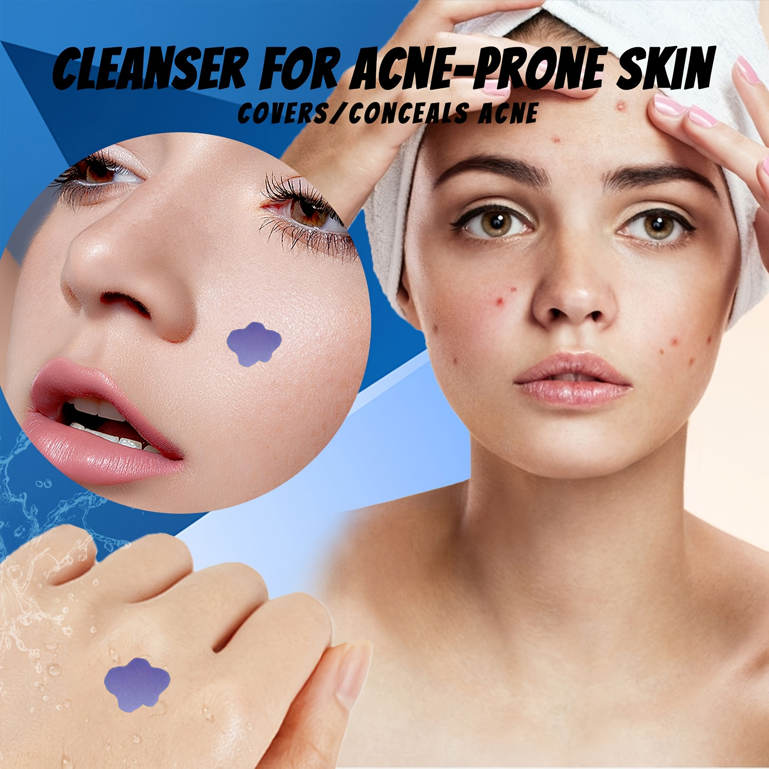 Microneedle Acne Pimple Patch  - Skincare You ulasan dan harga