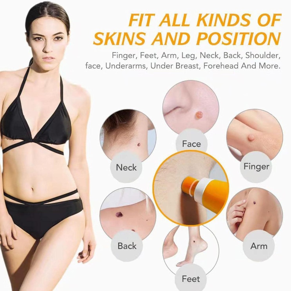 Auto Skin Tag Removal Kit For  - Skincare Ingredients Checker ulasan dan harga