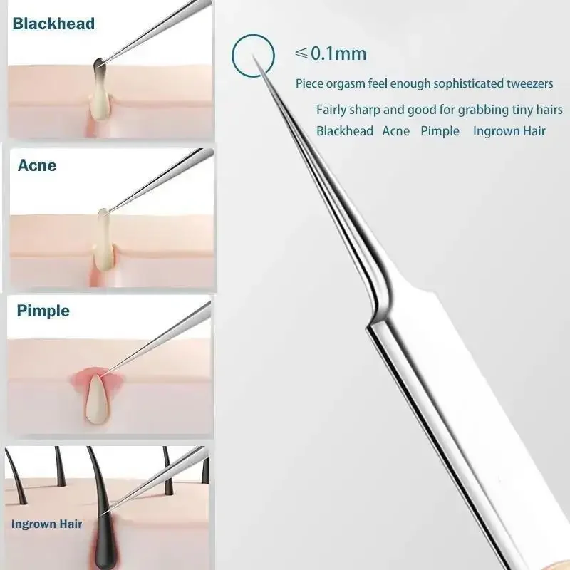 11Pcs/Set Acne Needle Blackhea - Skincare Ingredients Checker ulasan dan harga