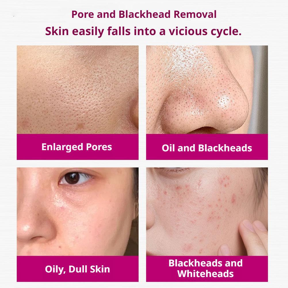 Salicylic Acid Shrink Pores Se - Aha Bha Exfoliant ulasan dan harga
