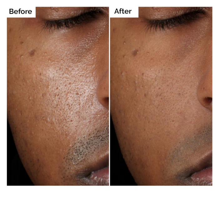 Aloe 2% + NAG 2% Solution Seru - Aha Bha Exfoliant ulasan dan harga