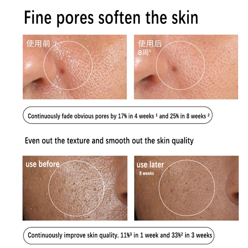 Aloe 2% + NAG 2% Solution Seru - Aha Bha Exfoliant ulasan dan harga