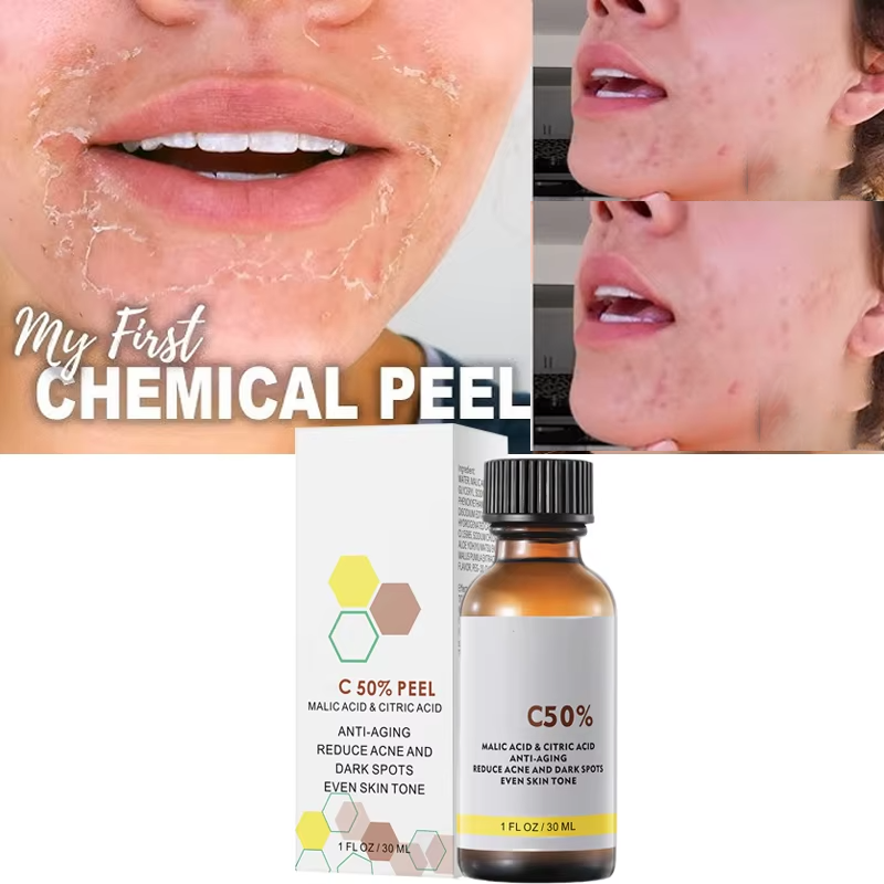 With Malic Acid And Citric Aci - Licorice Root Extract ulasan dan harga