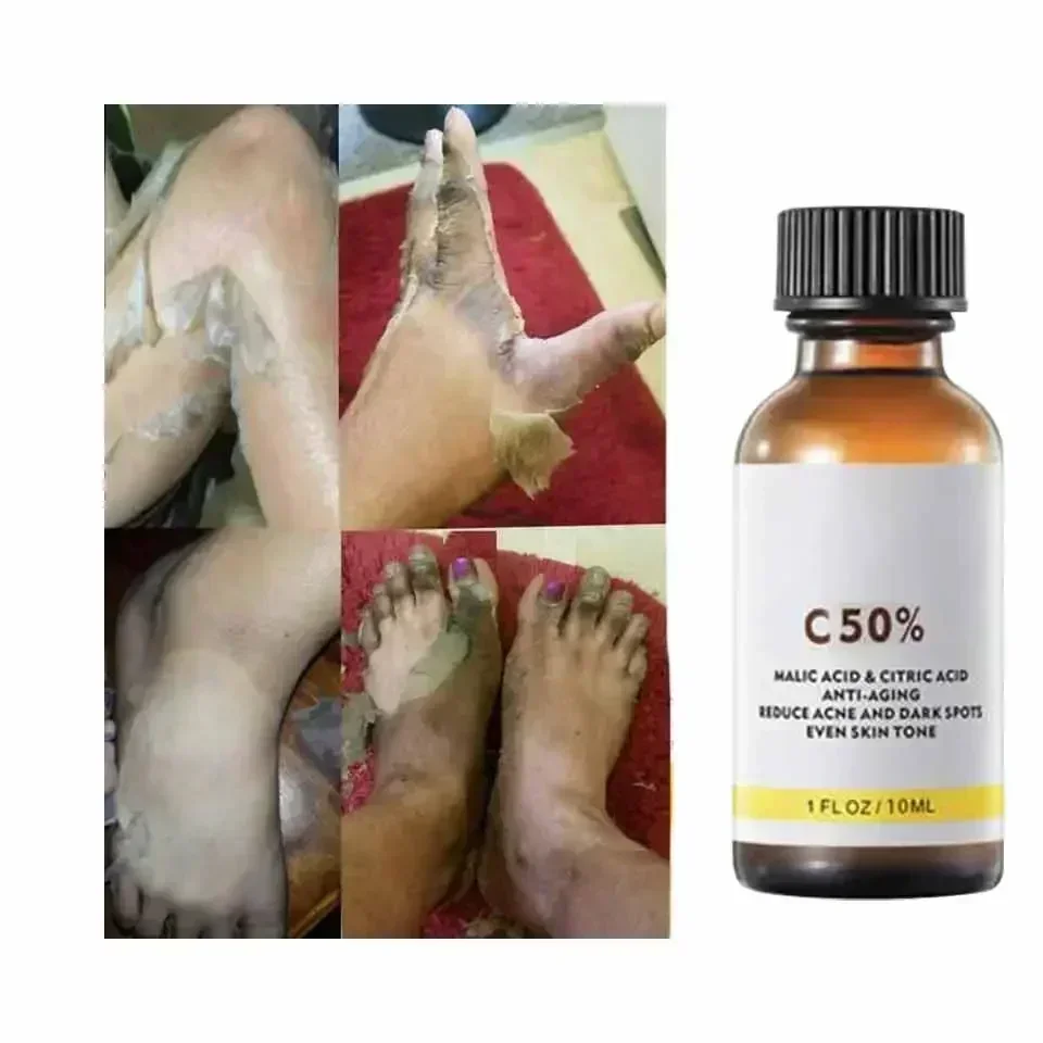 With Malic Acid And Citric Aci - Licorice Root Extract ulasan dan harga