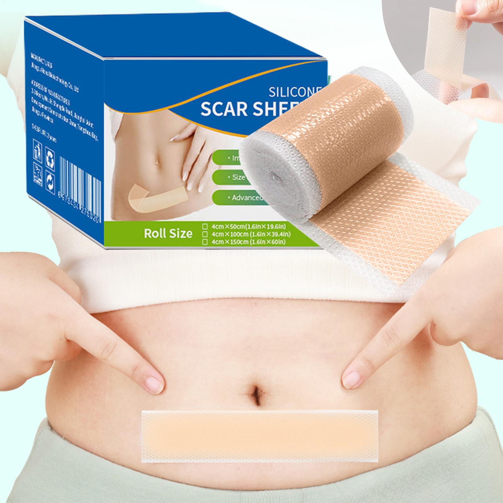 1 Roll Silicone Scar Sheets 4c - Collagen Sheet Mask ulasan dan harga